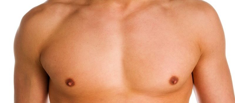 Мастэктомия при гинекомастии у мужчин (Обе груди)