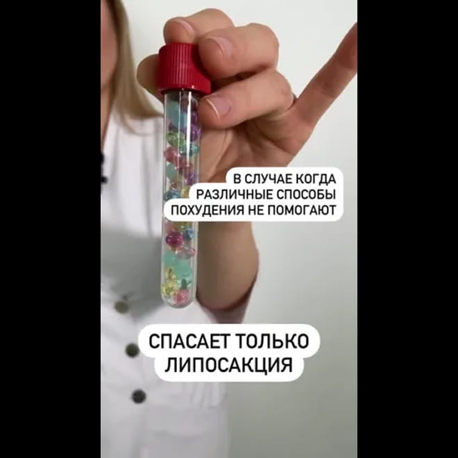 Липосакция